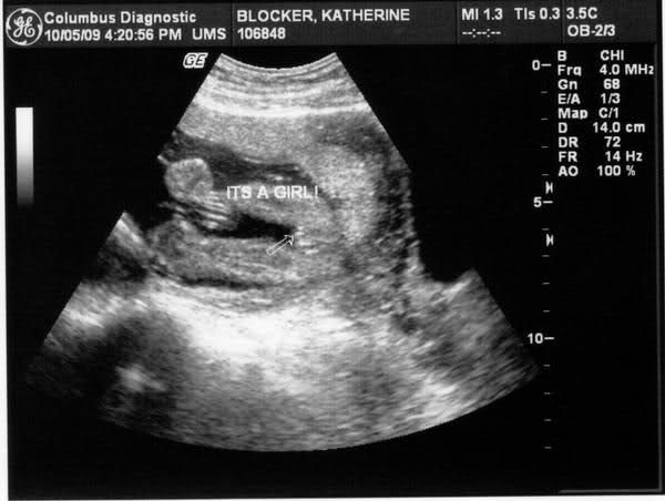 What To Expect With Ultrasound Done At 19th Week Of Pregnant With Pictures New Kids Center